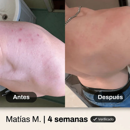 Shelter Derm - Gel limpiador corporal antiacné